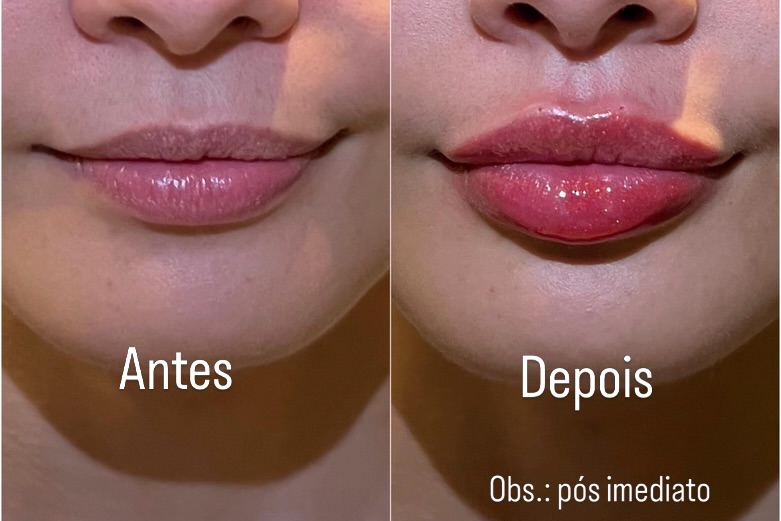 Registro de antes e depois de procedimento 1