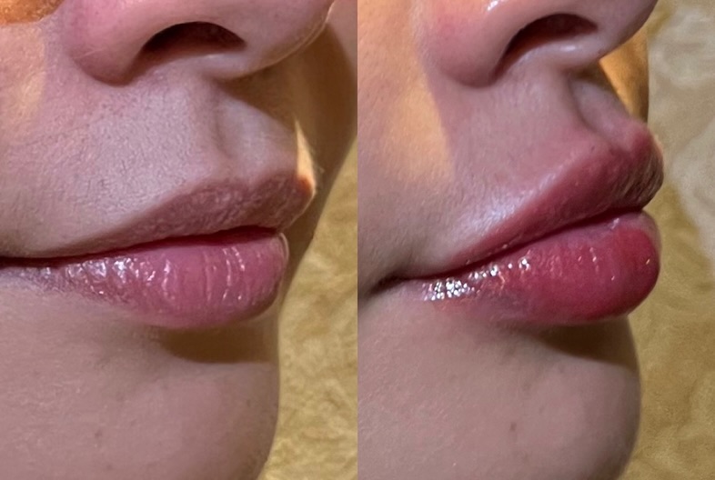Registro de antes e depois de procedimento 2